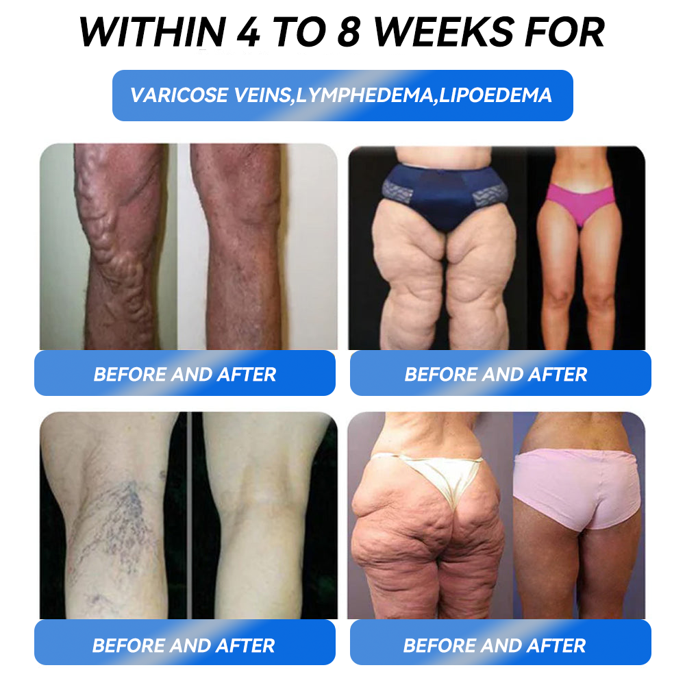 🧡Enjoy 30% OFF for adding the second one