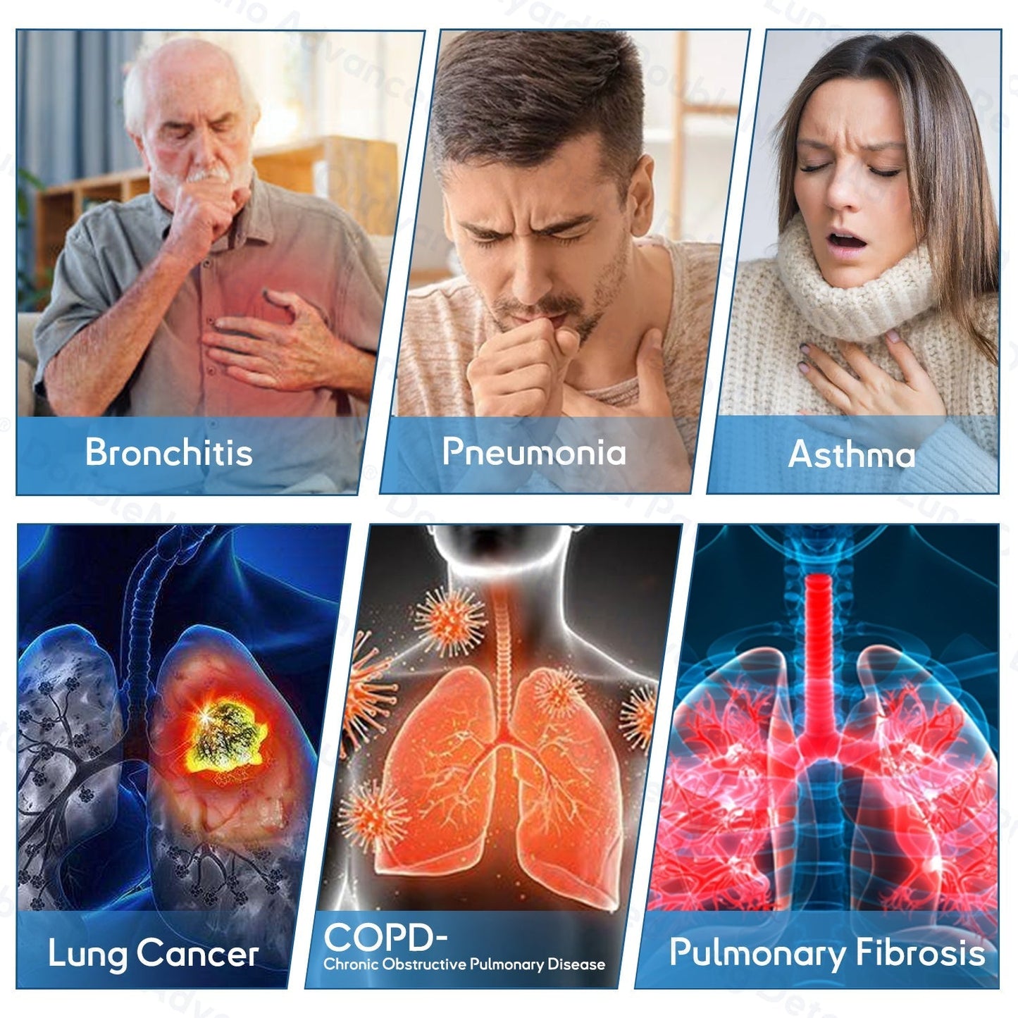 💫MHRA Approved|Zvoevo® DoubleNano COPD Relief Patch (💝 Cough, wheezing, shortness of breath, sputum, stuffy nose, bronchitis, bronchitis, allergy symptoms, lung discomfort🫁)